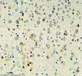 Immunohistochemical staining of RIM1/RIMS1 using anti-RIMS1 antibody. RIM1/RIMS1 was detected in a paraffin-embedded section of mouse brain tissue. Heat mediated antigen retrieval was performed in EDTA buffer (pH 8.0, epitope retrieval solution). The tissue section was blocked with 10% goat serum. The tissue section was then incubated with 2 ug/ml rabbit anti-RIMS1 antibody overnight at 4oC. Peroxidase Conjugated Goat Anti-rabbit IgG was used as secondary antibody and incubated for 30 min at 37oC.