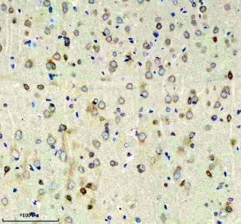 Immunohistochemical staining of RIM1/RIMS1 using anti-RIMS1 antibody. RIM1/RIMS1 was detected in a paraffin-embedded section of mouse brain tissue. Heat mediated antigen retrieval was performed in EDTA buffer (pH 8.0, epitope retrieval solution). The tissue section was blocked with 10% goat serum. The tissue section was then incubated with 2 ug/ml rabbit anti-RIMS1 antibody overnight at 4oC. Peroxidase Conjugated Goat Anti-rabbit IgG was used as secondary antibody and incubated for 30 min at 37oC.