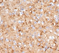IHC staining of FFPE human brain tissue with recombinant SYP antibody (clone rSYP/6856). HIER: boil tissue sections in pH 9 10mM Tris with 1mM EDTA for 20 min and allow to cool before testing.