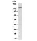 Western blot testing of human uterus lysate with KDM2A antibody at 0.5ug/ml. Predicted molecular weight: ~133kDa.