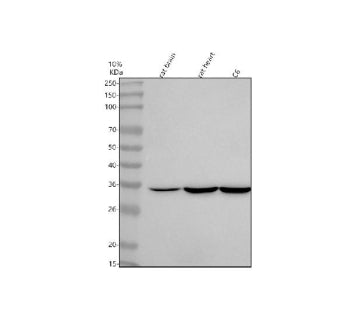 Western blot analysis of NTMT2 using anti-NTMT2 antibody. Lane 1: rat brain tissue lysates, Lane 2: rat heart tissue lysates, Lane 3: rat C6 whole cell lysates. After electrophoresis, proteins were transferred to a nitrocellulose membrane at 150 mA for 50-90 min. Blocked the membrane with 5% non-fat milk/TBS for 1.5 hour at RT.
