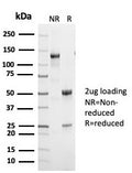 SDS-PAGE analysis of purified, BSA-free p53 antibody (clone TP53/7002R) as confirmation of integrity and purity.