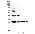Western blot testing of 1) rat liver, 2) rat kidney and 3) mouse kidney lysate with TL1A antibody at 0.5ug/ml. Predicted molecular weight ~28 kDa.