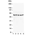Western blot testing of PPAR gamma antibody and Lane 1: MM453; 2: MM231; 3: HeLa; 4: Jurkat; 5: HT1080 cell lysate. Predicted molecular weight: 54-57 kDa.