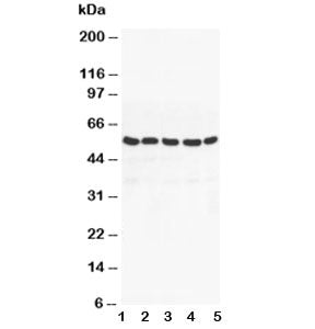 Western blot testing of PPAR gamma antibody and Lane 1: MM453; 2: MM231; 3: HeLa; 4: Jurkat; 5: HT1080 cell lysate. Predicted molecular weight: 54-57 kDa.