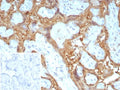 IHC staining of FFPE human placental tissue with Galectin-13 antibody (clone PP13/8897). Inset: PBS used in place of primary Ab (secondary Ab negative control). HIER: boil tissue sections in pH 9 10mM Tris with 1mM EDTA for 20 min and allow to cool before testing.