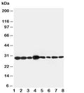 Western blot testing of LASP1 antibody and Lane 1: rat liver ; 2: rat spleen; 3: rat intestine; 4: Jurkat; 5: MCF-7; 6: A431; 7: HeLa; 8: 293T. Predicted molecular weight: 30kDa.