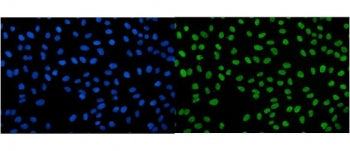 Immunofluorescent staining of FFPE human U-2 OS cells with IGF2-AS antibody (green) and DAPI nuclear stain (blue). HIER: steam section in pH6 citrate buffer for 20 min.