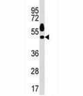 Sgk1 antibody western blot analysis in HeLa lysate.