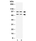 Western blot testing of human 1) SW620 and 2) U-2 OS lysate with PML antibody at 0.5ug/ml. Expected molecular weight: multiple isoforms from 47-97 kDa.