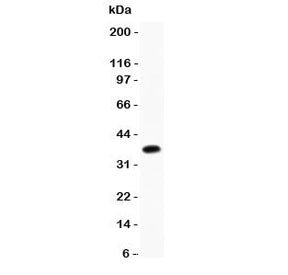 Western blot testing of CD23 antibody and mouse liver lysate. Expected molecular weight: 37~45 kDa.