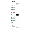 Western blot testing of human brain tissue with GFAP antibody. Predicted molecular weight ~50 kDa.