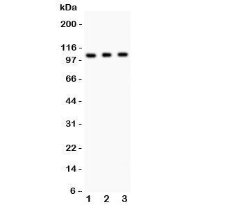 Western blot testing of GRIK1 antibody and Lane 1: mouse brain; 2: mouse brain; 3: human SHG-44 (glioma) lysate. Predicted molecular weight: ~104/150+ kDa (unmodified/glycosylated).