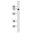 Western blot testing of rat brain lysate with VGLUT2 antibody at 1:2000. Predicted molecular weight ~64 kDa.