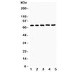 Western blot testing of RIP1 antibody and Lane 1: Jurkat; 2: 22RV1; 3: MCF-7; 4: HeLa; 5: A549. Expected/observed size ~76 kDa.
