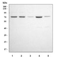 Western blot testing of 1) human K562, 2) human 293T, 3) human SH-SY5Y, 4) human HepG2 and 5) rat brain tissue lysate with IGSF8 antibody. Predicted molecular weight ~65 kDa.
