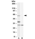Western blot testing of HeLa cell lysate with PRPF31 antibody at 1ug/ml with [B] and without [A] blocking/immunizing peptide. Predicted molecular weight: ~55kDa.