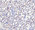 Immunocytochemical testing of PFA-fixed human 293T cells with B7-H3 antibody. HIER: pH9 EDTA.