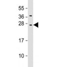 Western blot testing of human HepG2 cell lysate with CIDE B antibody at 1:2000. Predicted molecular weight: 25 kDa.