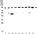 Western blot testing of rat 1) brain, 2) spleen, 3) heart, 4) kidney and mouse 5) brain, 6) spleen, 7) heart, 8) kidney and 9) testis lysate with Cullin 5 antibody at 0.5ug/ml. Predicted molecular weight ~91 kDa.
