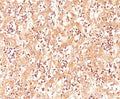 IHC testing of human fetal liver stained with AFP antibody (C3).