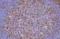 IHC staining of FFPE human tonsil tissue with CD3e antibody (clone C3e/8116R). HIER: boil tissue sections in pH 9 10mM Tris with 1mM EDTA for 20 min and allow to cool before testing.