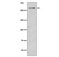 Western blot testing of mouse skeletal muscle with Dysferlin antibody. Predicted molecular weight ~230 kDa.