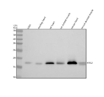 Western blot analysis of Myosin Light Chain 2/MLC-2V/MYL2 using anti-MYL2 antibody. Lane 1: human U20S whole cell lysates, Lane 2: monkey heart tissue lysates, Lane 3: rat heart tissue lysates, Lane 4: rat skeletal muscle tissue lysates, Lane 5: mouse heart tissue lysates, Lane 6: mouse skeletal muscle lysates. After electrophoresis, proteins were transferred to a nitrocellulose membrane at 150 mA for 50-90 min. Blocked the membrane with 5% non-fat milk/TBS for 1.5 hour at RT.