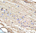IHC staining of zebrafish Cyp17a1 protein using Zebrafish Cyp17a1 antibody, HRP-labeled secondary and DAB substrate. Cyp17a1 was detected in a paraffin-embedded section of zebrafish spinal cord tissue. HIER: boil tissue sections in pH8 EDTA for 20 min and allow to cool before testing.