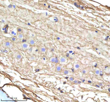 IHC staining of zebrafish Cyp17a1 protein using Zebrafish Cyp17a1 antibody, HRP-labeled secondary and DAB substrate. Cyp17a1 was detected in a paraffin-embedded section of zebrafish spinal cord tissue. HIER: boil tissue sections in pH8 EDTA for 20 min and allow to cool before testing.