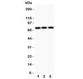 Western blot testing of APLP1 antibody and 1) human HeLa, 2) rat PC-12, and 3) mouse HEPA1-6 lysate; Expected molecular weight: 76 kDa (unmodified), ~86 kDa (soluble/glycosylated form), 92~95 kDa (mature form).