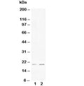 Western blot testing of 1) human HeLa and 2) rat PC-12 cell lysate with Bcl-XS antibody. Predicted/observed molecular weight: ~19 kDa.