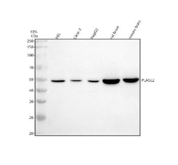 Western blot analysis of PLAGL2 using anti-PLAGL2 antibody. Electrophoresis was performed on a 10% SDS-PAGE gel at 80V (Stacking gel) / 120V (Resolving gel) for 2 hours. Lane 1: human HEL whole cell lysates, Lane 2: human Caco-2 whole cell lysates, Lane 3: human HepG2 whole cell lysates, Lane 4: rat brain tissue lysates, Lane 5: mouse brain tissue lysates. After electrophoresis, proteins were transferred to a nitrocellulose membrane at 150 mA for 50-90 min.