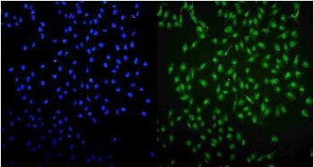 Immunofluorescent staining of FFPE human U-2 OS cells with UHRF1 antibody (green) and DAPI nuclear stain (blue). HIER: steam section in pH6 citrate buffer for 20 min.