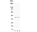 Western blot testing of BDNF antibody and Lane 1: rat brain; 2: mouse brain; 3: MCF-7; Predicted size: 28KD; Observed size: 37KD