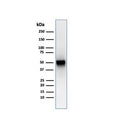 Western blot testing of human spleen lysate with recombinant PD-ECGF antibody (clone rTYMP/3444). Predicted molecular weight ~55 kDa.