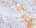 IHC staining of FFPE human tonsil with IL3RA antibody (clone CDLA123-1R). HIER: boil tissue sections in 10mM Tris with 1mM EDTA, pH 9 for 10-20 min and allow to cool.