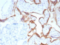 IHC staining of FFPE human placental tissue with Pappalysin-1 antibody (clone PAPPA/8804R). Inset: PBS used in place of primary Ab (secondary Ab negative control). HIER: boil tissue sections in pH 9 10mM Tris with 1mM EDTA for 20 min and allow to cool before testing.