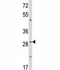 Western blot analysis of TTP antibody and WiDr lysate