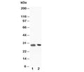 Western blot testing of BOB-1 antibody and Lane 1: rat spleen tissue lysate. Predicted molecular weight: ~28/35-40kDa (unmodified/ubiquitinated).