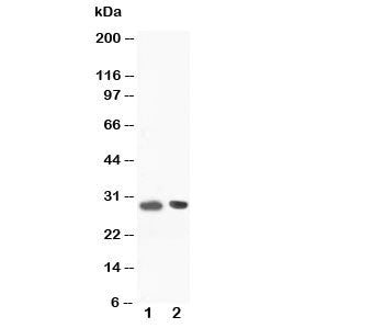 Western blot testing of BOB-1 antibody and Lane 1: rat spleen tissue lysate. Predicted molecular weight: ~28/35-40kDa (unmodified/ubiquitinated).
