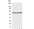 Western blot testing of SMAD5 antibody and Lane 1: human K562; 2: (h) Jurkat; 3: rat PC-12; 4: (h) HeLa; 5: (h) SMMC-7721 cell lysate. Observed molecular weight: 52~60 kDa.