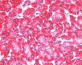 IHC staining of FFPE human pancreas with EIF4ENIF1 antibody with 5ug/ml. HIER: steamed with pH6 citrate buffer, AP-staining.
