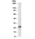 Western blot testing of mouse spleen lysate with biotinylated SOCS1 antibody at 1ug/ml. Predicted molecular weight ~24kDa, but also may be visualized at ~37kDa. An NAP blocker was used in place of non-fat milk as blocking solution and diluent. (1)