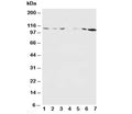 Western blot testing of NMDAR1 antibody and Lane 1: rat brain; 2: rat brain; 3: rat liver; 4: rat heart; 5: human MDA-MB-453; 6: human MDA-MB-231; 7: human HeLa lysate. Predicted molecular weight ~105 kDa.
