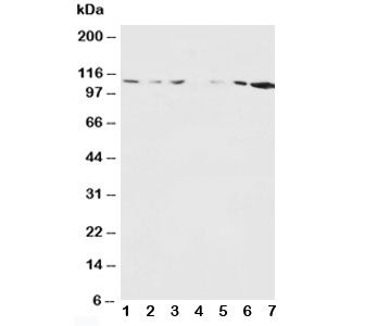 Western blot testing of NMDAR1 antibody and Lane 1: rat brain; 2: rat brain; 3: rat liver; 4: rat heart; 5: human MDA-MB-453; 6: human MDA-MB-231; 7: human HeLa lysate. Predicted molecular weight ~105 kDa.