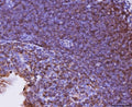 IHC staining of FFPE mouse intestinal lymph node tissue with Cxcr3 antibody. HIER: boil tissue sections in pH8 EDTA for 20 min and allow to cool before testing.