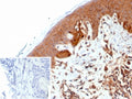 IHC staining of FFPE human skin tissue with Nucleoside diphosphate kinase B antibody (clone NME2/6434). Inset: PBS used in place of primary Ab (secondary Ab negative control). HIER: boil tissue sections in pH 9 10mM Tris with 1mM EDTA for 20 min and allow to cool before testing.