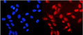 Immunofluorescent staining of FFPE human U-2 OS cells with Neurofibromin antibody (red) and DAPI nuclear stain (blue). HIER: steam section in pH6 citrate buffer for 20 min.