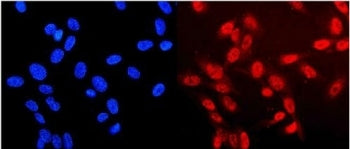 Immunofluorescent staining of FFPE human U-2 OS cells with Neurofibromin antibody (red) and DAPI nuclear stain (blue). HIER: steam section in pH6 citrate buffer for 20 min.